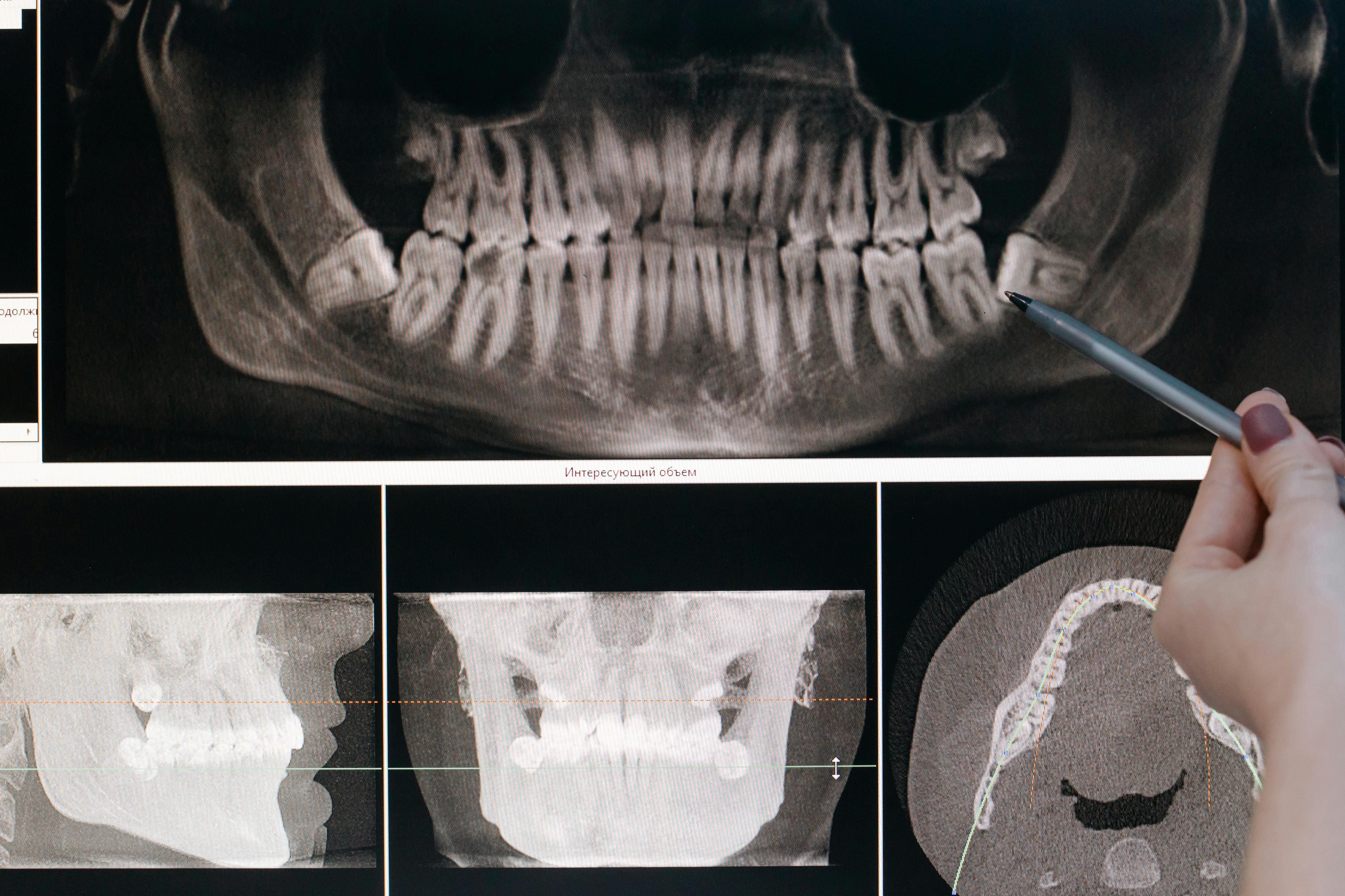 Maxillofacial Surgery Image 1
